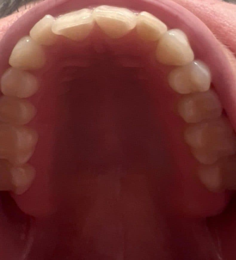 Upper teeth seen from below