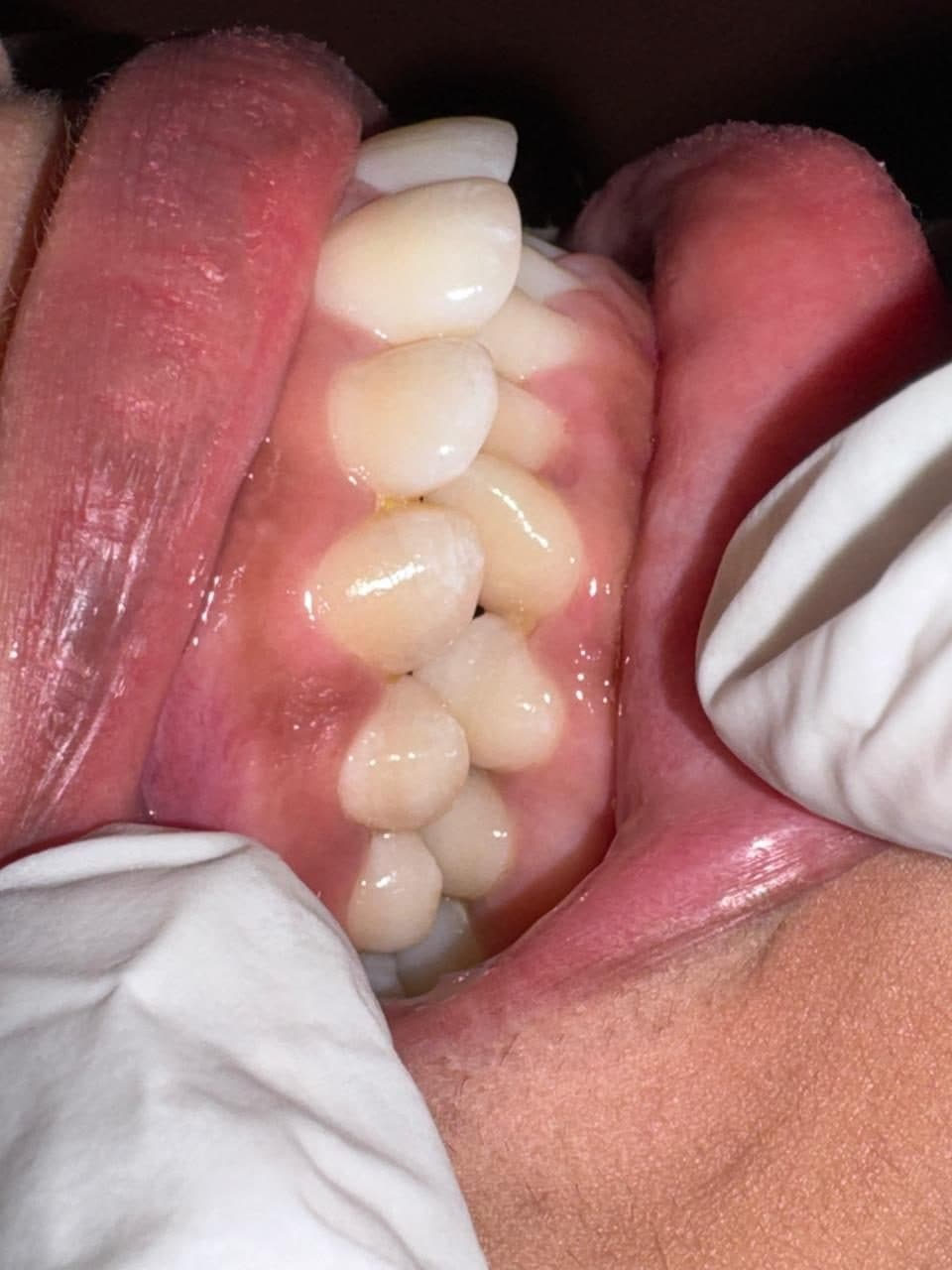 Upper teeth seen from below