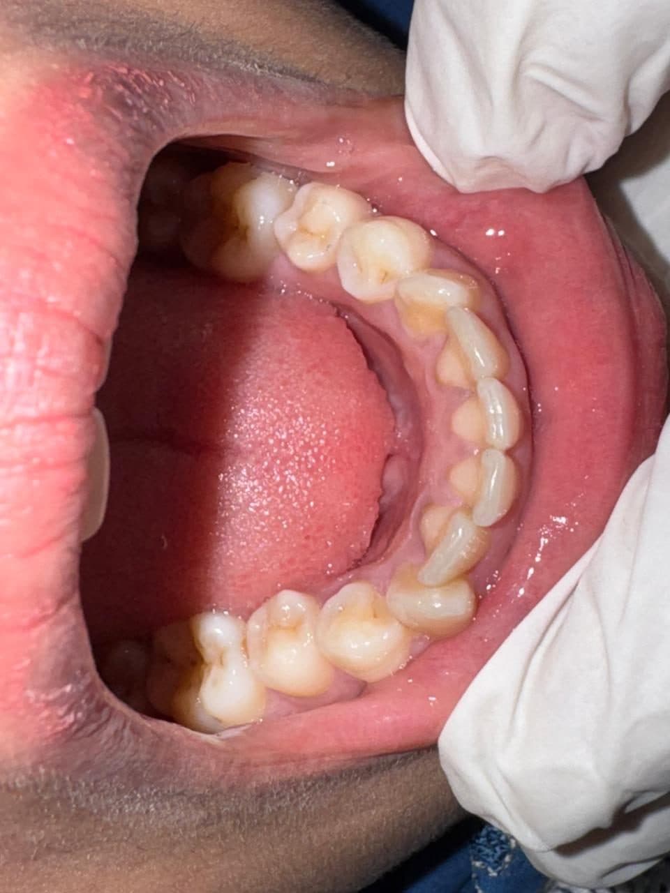 Lower teeth seen from above