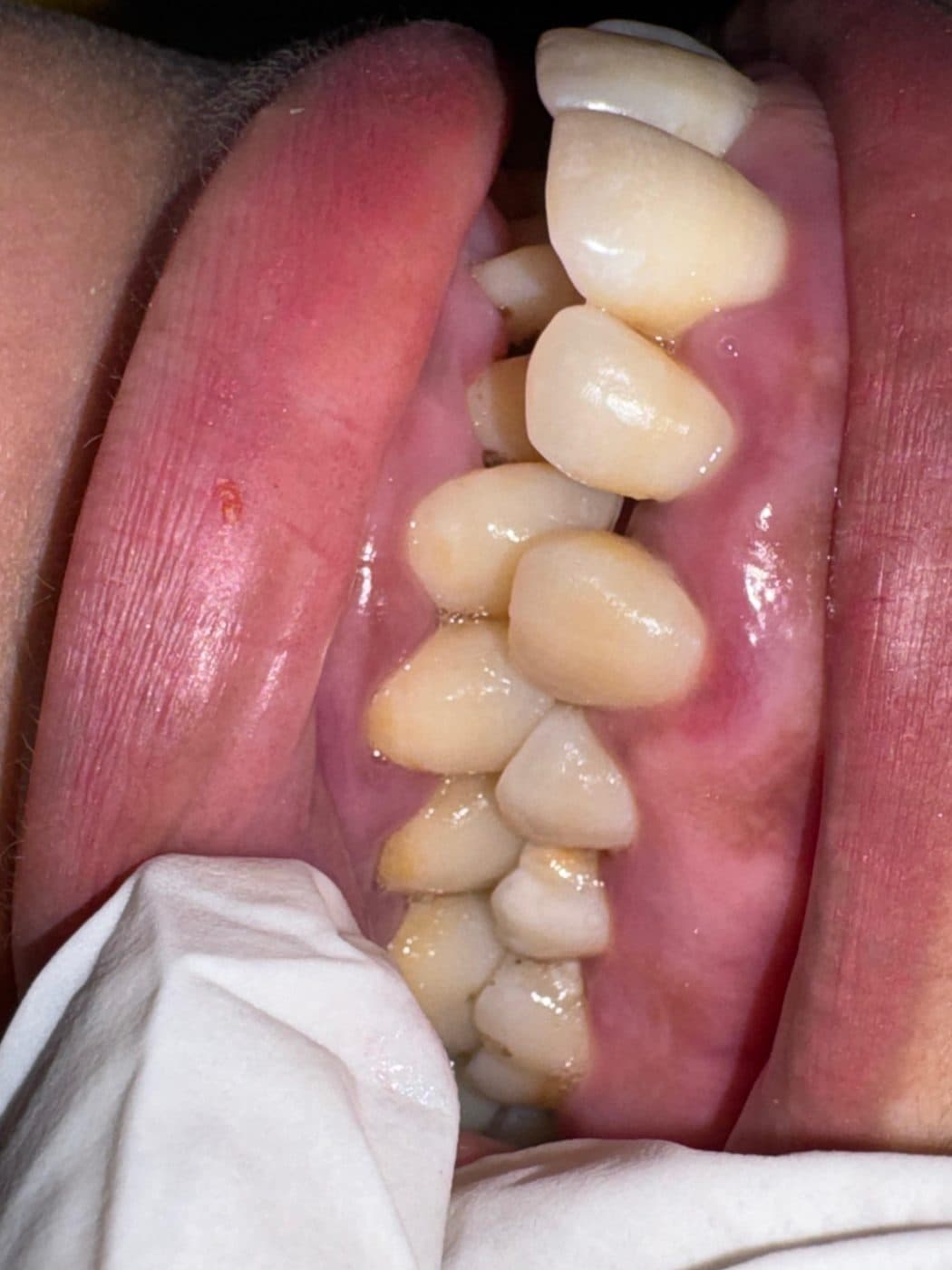 Upper teeth seen from below