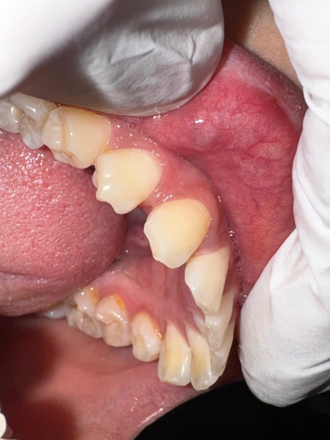 Upper teeth seen from below